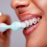 Electric Toothbrushes and Braces: Tips and Tricks for a Cleaner Smile